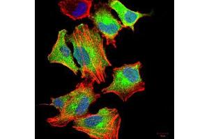 Immunofluorescence analysis of A549 cells using CSF3 mouse mAb (green).
