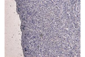 ABIN334386 Negative Control showing staining of paraffin embedded Human Heart, with no primary antibody