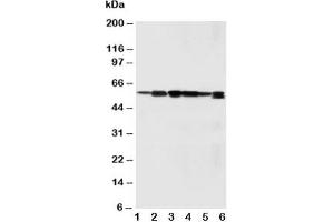Western blot testing of SSH3BP1 antibody and Lane 1:  rat liver;  2: rat brain;  3: MM231;  4: HeLa;  5: SMMC-7721;  6: Jurkat cell lysate (ABI1 anticorps  (C-Term))
