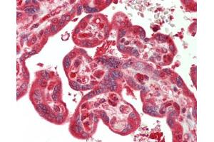 Human Placenta: Formalin-Fixed, Paraffin-Embedded (FFPE)