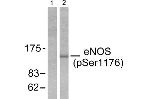 Western blot analysis of extracts from Hela cells treated with Insulin (0. (ENOS anticorps  (pSer1176))