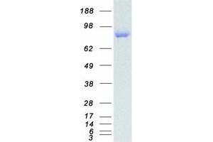 Validation with Western Blot