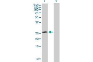 Western Blot analysis of CEP27 expression in transfected 293T cell line by CEP27 MaxPab polyclonal antibody.