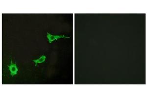 Immunofluorescence analysis of LOVO cells, using ADRA1B antibody. (ADRA1B anticorps  (C-Term))