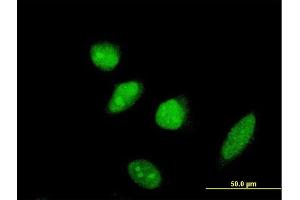 Immunofluorescence of monoclonal antibody to SCML2 on HeLa cell. (SCML2 anticorps  (AA 251-350))