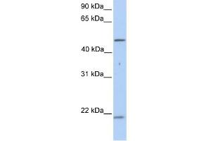 WB Suggested Anti-KRT10 Antibody Titration:  0. (Keratin 10 anticorps  (N-Term))