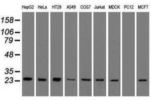 Image no. 8 for anti-Cardiac Troponin I (TNNI3) antibody (ABIN1497101)