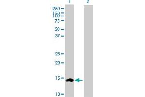 Western Blot analysis of CCL24 expression in transfected 293T cell line by CCL24 MaxPab polyclonal antibody. (CCL24 anticorps  (AA 1-119))