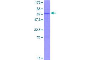 Image no. 1 for Menage A Trois Homolog 1, Cyclin H Assembly Factor (Xenopus Laevis) (MNAT1) (AA 1-309) protein (GST tag) (ABIN1311102)