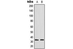 Western blot analysis of GDF15 expression in HepG2 (A), NIH3T3 (B) whole cell lysates. (GDF15 anticorps  (Center))
