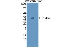 Figure. (TRRAP anticorps  (AA 3534-3770))