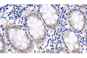 Detection of CASP8 in Human Colon Tissue using Polyclonal Antibody to Caspase 8 (CASP8)