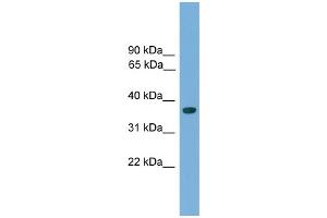 WB Suggested Anti-Hoxa1 Antibody Titration:  0.