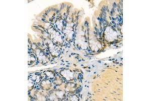 Immunohistochemistry of paraffin embedded mouse colon using Thymosin (ABIN7075306) at dilution of 1:1500 (400x lens)