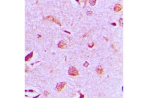 Immunohistochemical analysis of MAST3 staining in human brain formalin fixed paraffin embedded tissue section. (MAST3 anticorps  (C-Term))