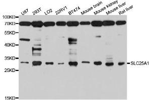 Western blot analysis of extract of various cells, using SLC25A1 antibody. (Slc25a1 anticorps)