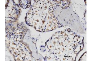 anti-Hematopoietic SH2 Domain Containing (HSH2D) (AA 251-352) antibody