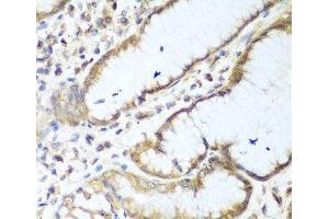 Immunohistochemistry of paraffin-embedded Human stomach using NUDT15 Polyclonal Antibody at dilution of 1:100 (40x lens). (NUDT15 anticorps)