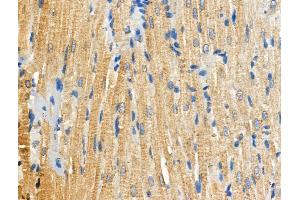 Phospho-RIPK3 (Ser227) Antibody at 1/100 staining Rat heart tissue by IHC-P.