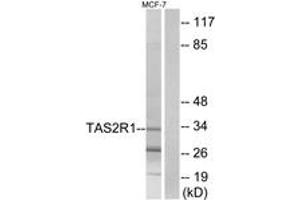 Western blot analysis of extracts from MCF-7 cells, using TAS2R1 Antibody.