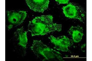 Image no. 1 for anti-Mitochondrial Ribosomal Protein L12 (MRPL12) (AA 1-199) antibody (ABIN598585) (MRPL12 anticorps  (AA 1-199))