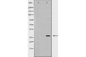 Western blot analysis of K562 whole cell lysates, using HLA-DQA1 Antibody. (HLA-DQA1 anticorps)