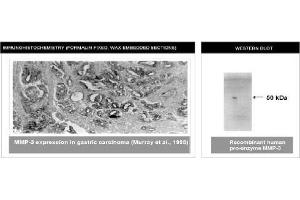 Immunohistochemistry (IHC) image for anti-Matrix Metallopeptidase 3 (Stromelysin 1, Progelatinase) (MMP3) (C-Term) antibody (ABIN264506) (MMP3 anticorps  (C-Term))