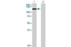 Lane 1: hCG_40738 transfected lysate ( 102. (TET3 293T Cell Transient Overexpression Lysate(Denatured))