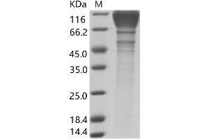 Western Blotting (WB) image for Human Immunodeficiency Virus 1 Surface Glycoprotein (HIV-1 gp120) protein (His tag) (ABIN7196133)