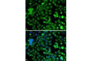 Immunofluorescence analysis of A-549 cells using KLF9 antibody (ABIN6142927). (KLF9 anticorps  (AA 1-150))