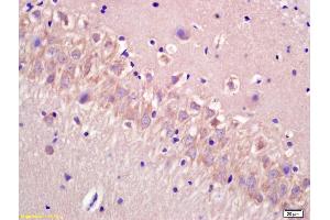 Formalin-fixed and paraffin embedded rat brain labeled with Anti-CECR5 Polyclonal Antibody, Unconjugated (ABIN872871) at 1:200 followed by conjugation to the secondary antibody and DAB staining.