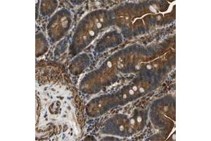 Immunohistochemical staining of human colon with ERGIC1 polyclonal antibody  shows strong cytoplasmic and membranous positivity in glandular cells at 1:20-1:50 dilution. (ERGIC1 anticorps)
