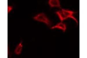ABIN6269122 staining NIH-3T3 by IF/ICC. (c-MET anticorps  (C-Term))