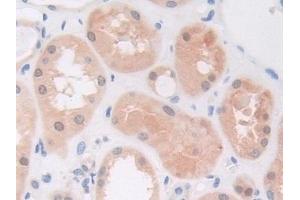 Detection of PIK3Cb in Human Kidney Tissue using Polyclonal Antibody to Phosphoinositide-3-Kinase Catalytic Beta Polypeptide (PIK3Cb)