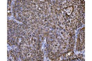 IHC analysis of TRBP/TARBP2 using anti-TRBP/TARBP2 antibody (ABIN7600548). (TARBP2 anticorps  (AA 20-366))