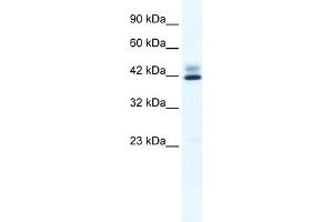 WB Suggested Anti-ZNF551 Antibody Titration:  0. (ZNF551 anticorps  (N-Term))