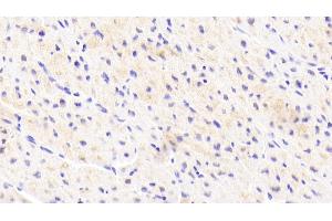 Detection of GOLPH2 in Human Cardiac Muscle Tissue using Polyclonal Antibody to Golgi Phosphoprotein 2 (GOLPH2)