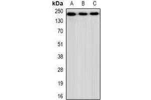Western blot analysis of CHD4 expression in HEK293 (A), NIH3T3 (B), H9C2 (C) whole cell lysates. (CHD4 anticorps)