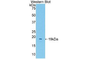 WB of Protein Standard: different control antibodies against Highly purified E. (CD31 Kit ELISA)