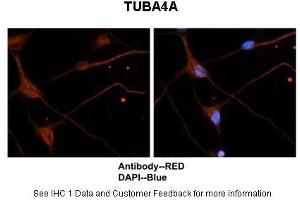 Sample Type :  Mouse brain stem cells  Primary Antibody Dilution :  1:500  Secondary Antibody :  Goat anti-rabbit Alexa-Fluor 594  Secondary Antibody Dilution :  1:1000  Color/Signal Descriptions :  TUBA4A: Red DAPI:Blue  Gene Name :  TUBA4A   Submitted by :  Dr.