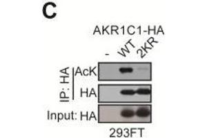 AKR1C1 is acetylated at Lysines 185 and 201.