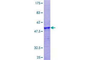 Image no. 1 for Vitamin K-dependent protein C (PROC) (AA 1-166) protein (GST tag) (ABIN1316192)