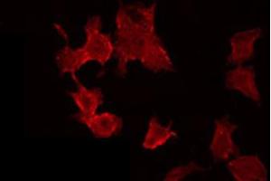 ABIN6272400 staining MCF7 by IF/ICC. (POTE-14/22 anticorps)
