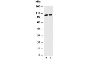 Western blot with TRIF antibody and Lane 1: Jurkat