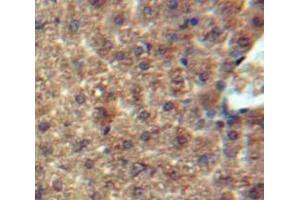Used in DAB staining on fromalin fixed paraffin-embedded Liver tissue (CCL7 anticorps  (AA 24-99))
