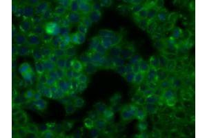 Image no. 2 for anti-Bruton Agammaglobulinemia tyrosine Kinase (BTK) antibody (ABIN1496974) (BTK anticorps)