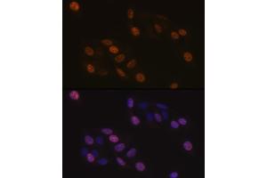Immunofluorescence analysis of U-2 OS cells using KIFC1 Rabbit mAb (ABIN1680485, ABIN3015039, ABIN3015040 and ABIN7101305) at dilution of 1:100 (40x lens).