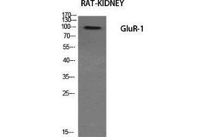 Western Blot (WB) analysis of specific cells using GluR-1 Polyclonal Antibody. (Glutamate Receptor 1 anticorps  (Ser43))