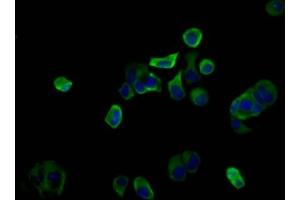 Immunofluorescence staining of MCF-7 cells with ABIN7163222 at 1:100, counter-stained with DAPI. (PIGQ anticorps  (AA 616-760))