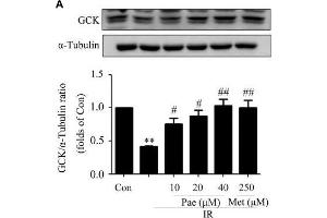 Paeonol regulated the phosphorylation of Akt and the protein contents of GCK and LDLR in insulin-resistant HepG2 cells.